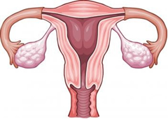 fibroid surgery