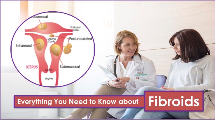 Everything About Uterine Fibroids
