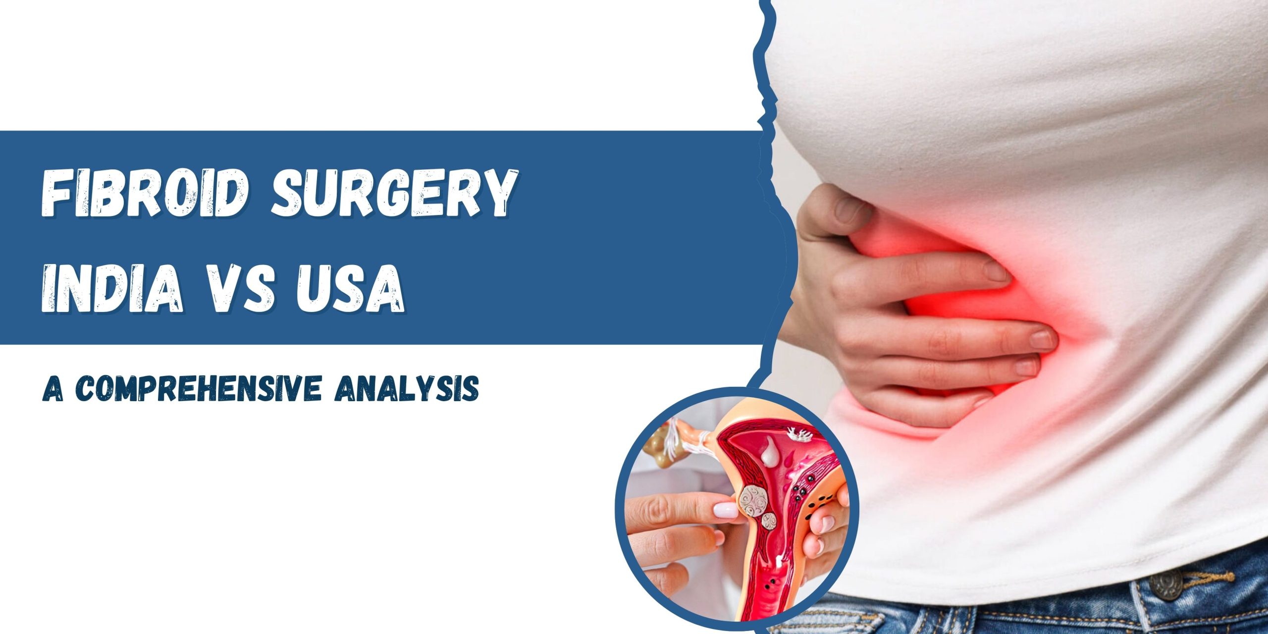 Fibroid Surgery India vs USA