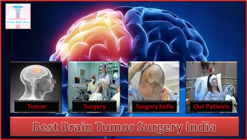 Cost Of Brain Tumor Surgery In India