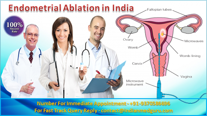 Endometrial Ablation Cost In India