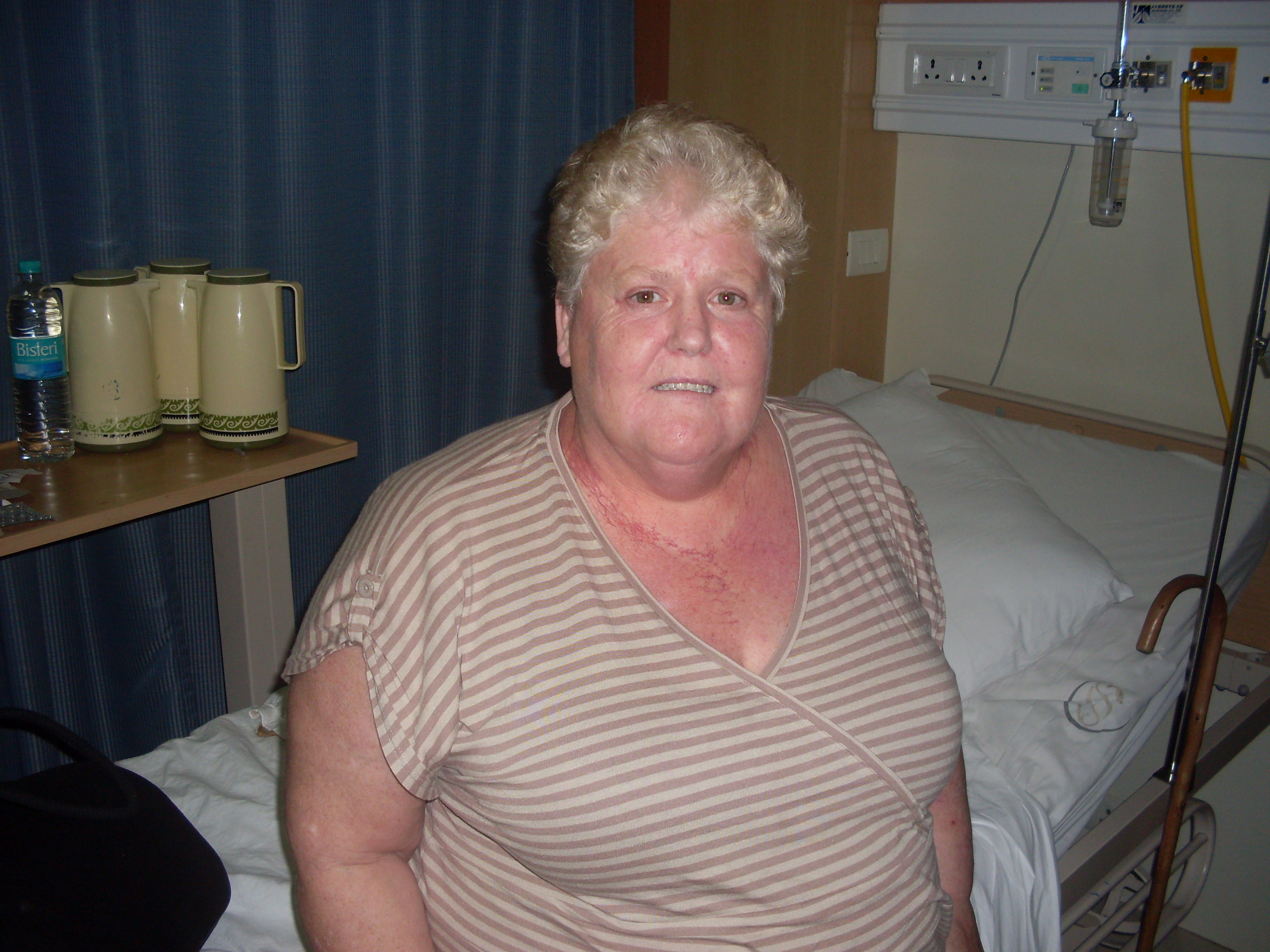 Sleeve Gastrectomy Surgery in Delhi India